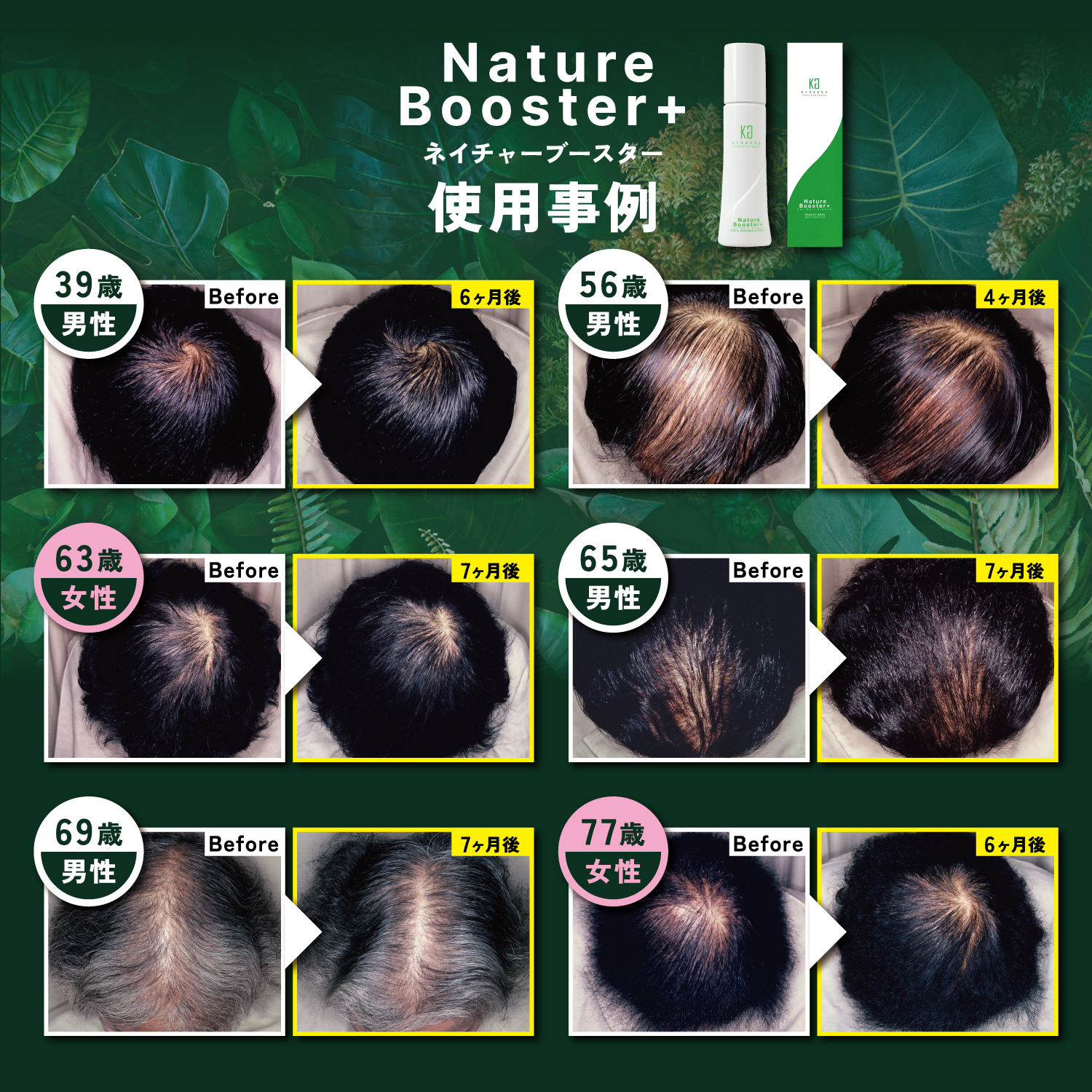 KYOGOKU ネイチャーブースター 育毛剤 医薬部外品 ヘアトニック 薬用育毛トニック 男女兼用 無添加 抜け毛予防