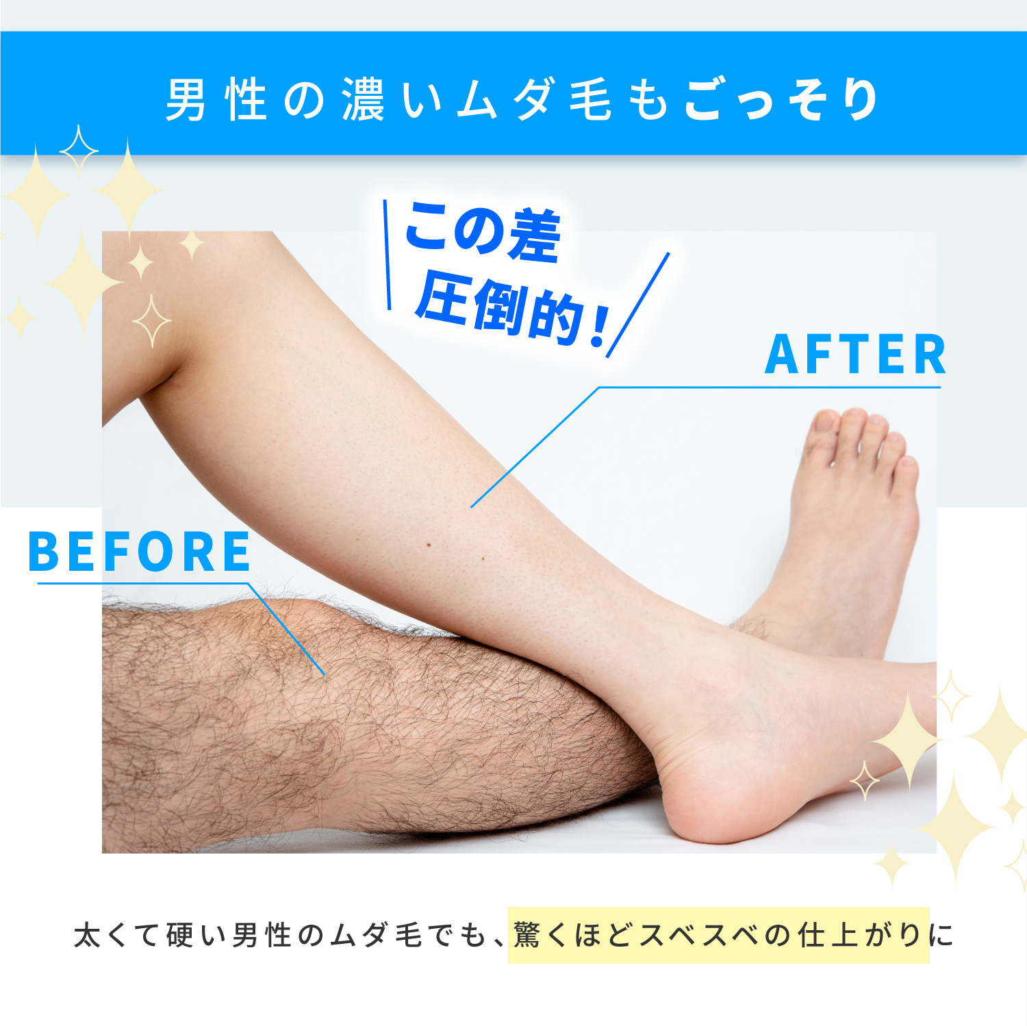 KYOGOKU リムーバークリーム 除毛クリーム 医薬部外品 日本製 Vio対応 低刺激 ムダ毛 敏感肌 脱毛剤